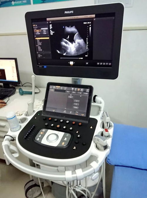 超聲檢查再添利器，來廣華體驗國際高端彩超設(shè)備