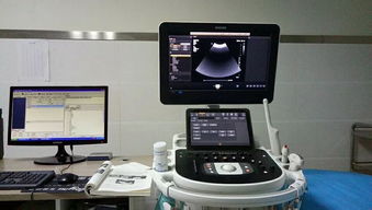 旬陽(yáng)縣醫(yī)院成功引進(jìn)先進(jìn)超聲設(shè)備，正式開(kāi)通新生兒顱腦超聲檢查服務(wù)